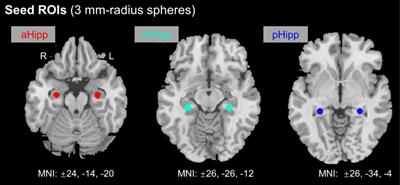 Abnormal Functional Connectivity of Hippocampal Subdivisions in Obstructive Sleep Apnea: A Resting-State Functional Magnetic Resonance Imaging Study